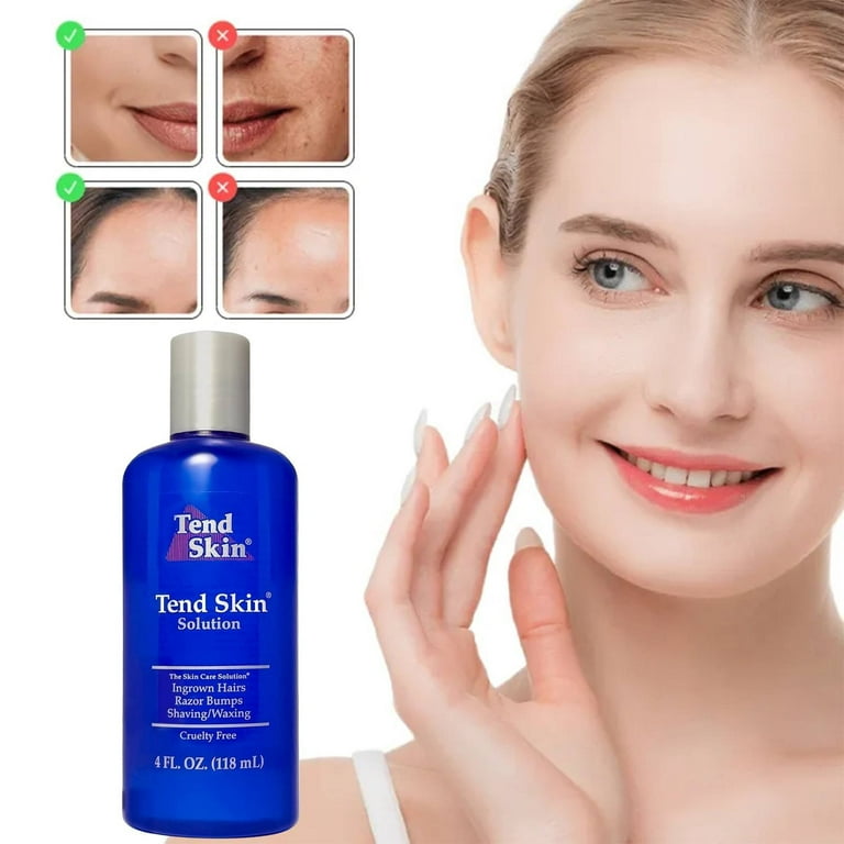 Tend Skin Razor Bump, Ingrown Hair Solution for Unsightly Razor Bumps, Ingrown Hair and Razor Burns, Post Shaving and Waxing Toner for Men and Women, Made in USA, 4 Oz