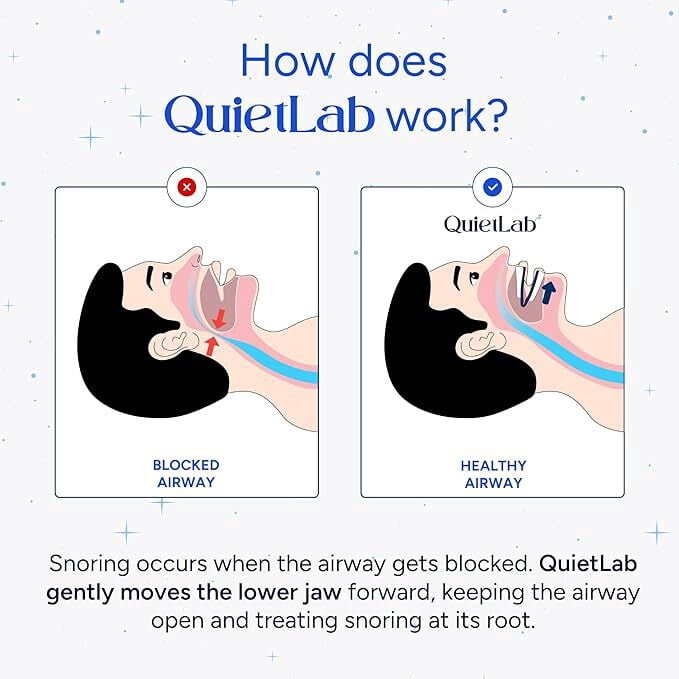 QuietLab Pro Anti-Snoring Mouthpiece – Adjustable Night Guard for Snoring Relief, No-Boil Custom Fit, Orthodontist-Designed, BPA-Free Medical Grade Material