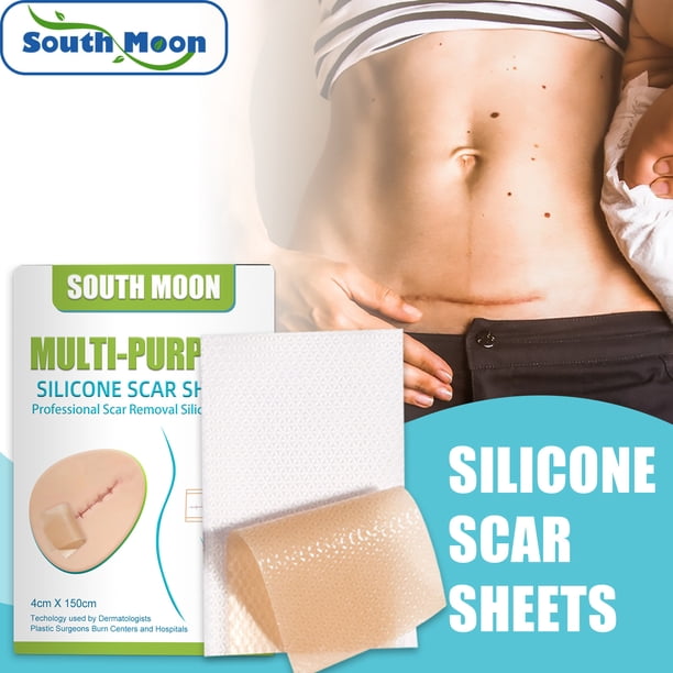 Parche de silicona profesional para cicatrices, parche reutilizable para cicatrices, suaviza y repara cicatrices, para lesiones, quemaduras, acné, cirugía C y estrías, lavable (4 cm x 150 cm) ER