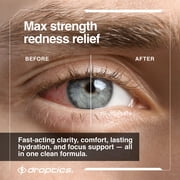 Droptics Extra Strength Redness Relief Eye Drops, Moisturizing Relief for Dry and Tired Eyes, 5ml (0.17 fl oz)