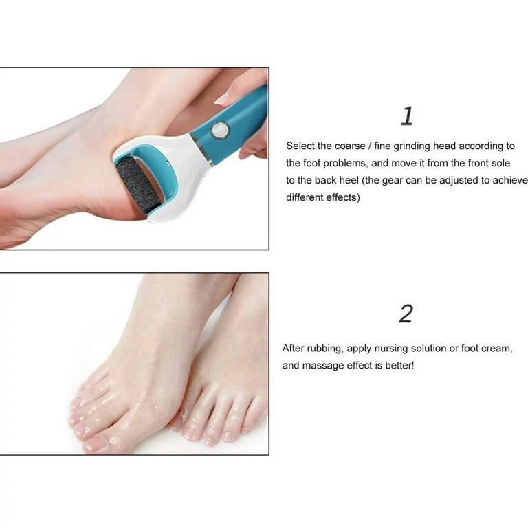 PrettyClaw Callus Remover Foot File Pedicure File Callus Tool Corn Remover  Removes Dead Skin Foot Skin File Rasp Callus Shaver Heel Scraper for Feet