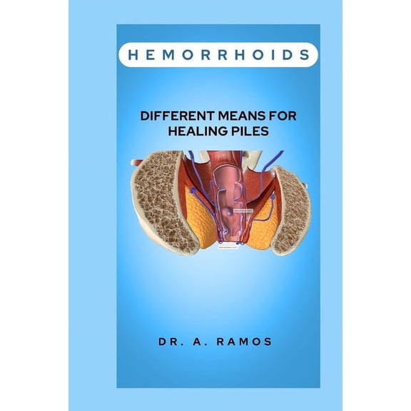 Hemorrhoids: Different Means for Healing Piles (Paperback)