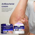 thumbnail image 3 of South Moon Purple Didin Crema antipicazón para la piel Alivio de la picazón en la piel Crema tópica para picaduras de mosquitos | |, 3 of 4