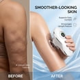 thumbnail image 5 of Premium 3-in-1 Sculpting Beauty Device, Microcurrent Vacuum Red Light Skin Firming Machine, Dual Face & Body Mode with 2 Cups  for Full Body Daily Care, 5 of 6