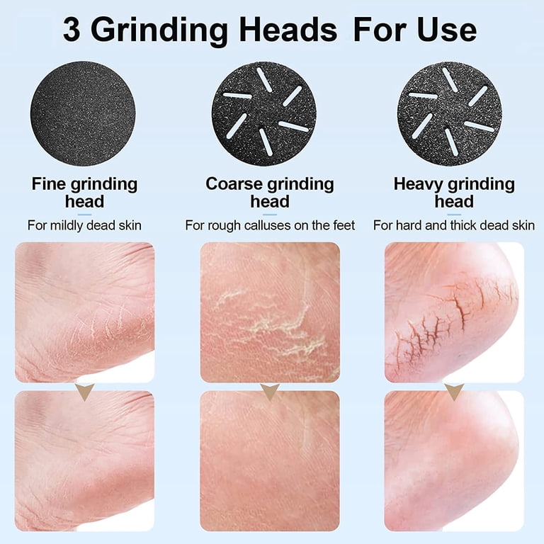 Prociv Electric Foot Callus Remover with Vacuum, 3 Heads photo 6