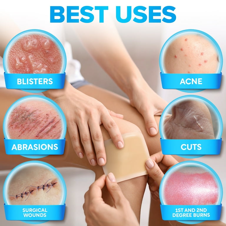 hydrocolloid dressing for deep cuts JJ CARE Hydrocolloid Dressing [Pack 10], 4x4, 0.8MM Thick, Wound Care for  Bedsores, Blisters