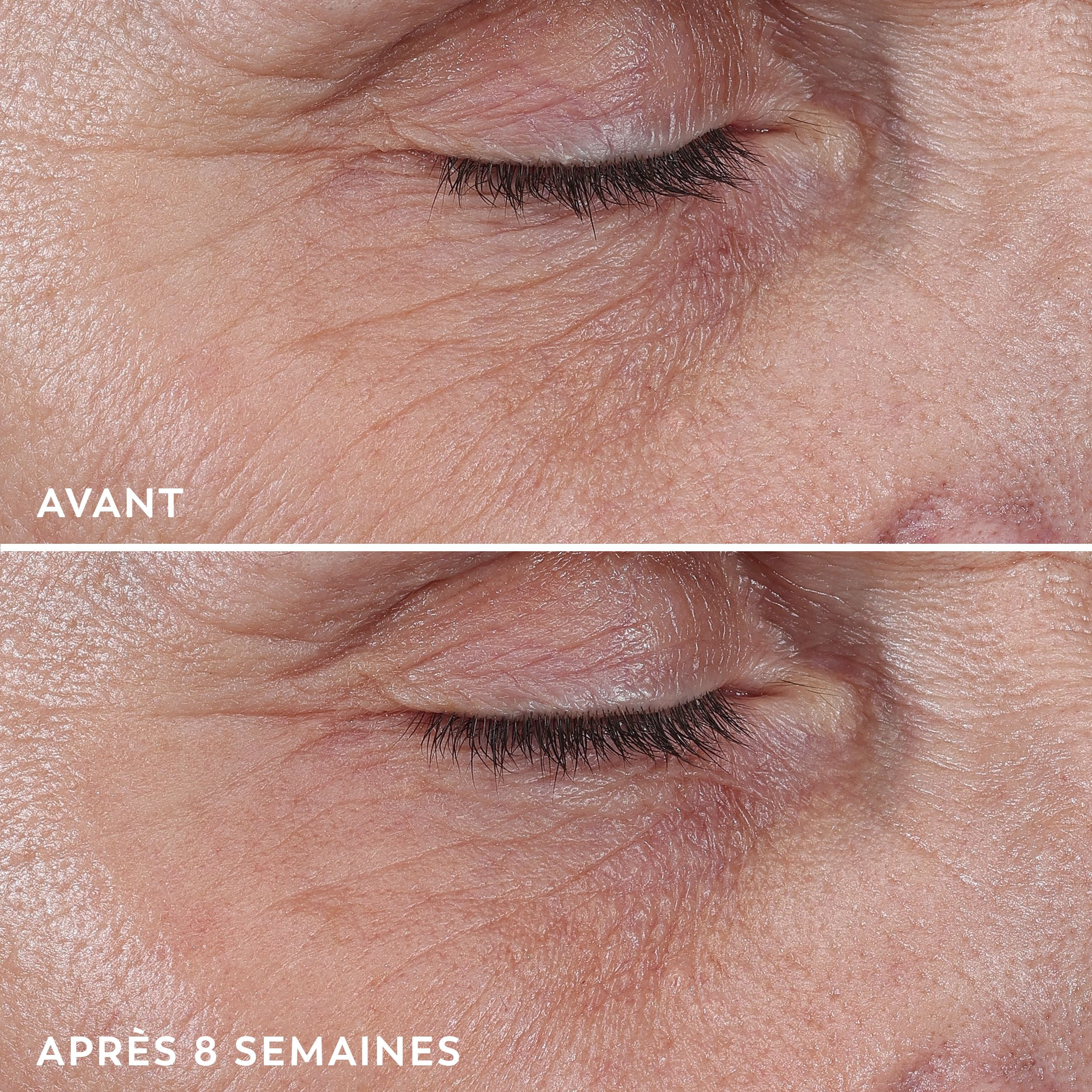 Crème pour le visage Olay, crème microsculptante hydratante pour le visage Regenerist, sans parfum – Hydratant, anti-âge, anti-rides, soins de la peau – Acide hyaluronique, niacinamide 50 mL