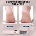 thumbnail image 5 of Portable Electric Callus Remover USB Rechargeable Foot Grinder with 2 Speed Modes & Dual Roller Heads for Dead Skin Removal, 5 of 5
