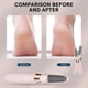 thumbnail image 5 of Portable Electric Callus Remover USB Rechargeable Foot Grinder with 2 Speed Modes & Dual Roller Heads for Dead Skin Removal, 5 of 5