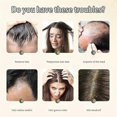thumbnail image 3 of Ginger Plant Extract Anti-hair Loss Hair Shampoo, 2024 New Ginger Plant Extract Anti-hair Loss Hair Shampoo, Ginger Shampoo For Hair Growth_c*, 3 of 5