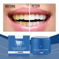 thumbnail image 1 of Hauiodp Whitening Powder - Teeth Whitening Powder for Instant Stain Removal, Color Corrector, and Toothpaste Booster-Lasting Whitening Results, No Sensitivity, 1 of 9