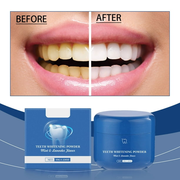 Fiudx Polvo Blanqueador Dental con Sabor a Menta, Elimina Manchas y Limpia Dientes. Limpiador Suave para Una Sonrisa Radiante. Higiene Bucal Diaria.