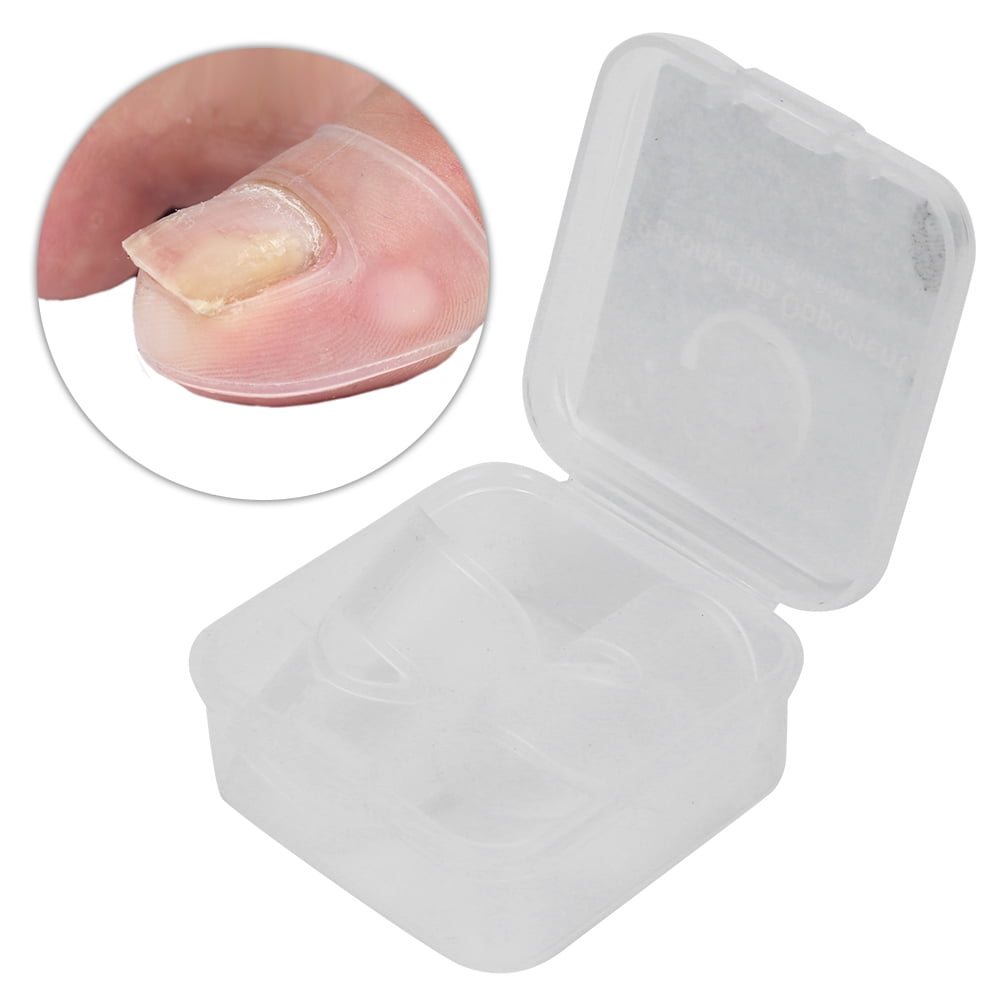 Mgaxyff 2pcs Silicone Ingrown Toenail Correcting Tool Pain Relief Paronychia Treatment Corrector,Ingrowing Nail Corrector