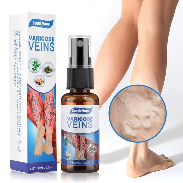 Crema para tratamiento de venas varicosas, pomada para angitis y varices, alivio del dolor de venas, flebitis, yeso médico, tratamiento para el cuidado de la salud, 30g