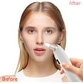 thumbnail image 6 of CCNZZITSHT Electric Blackhead Remover Vacuum 4 Suction Power Mode Blackhead Remover Tool Black Head Remover for Face Whitehead Remover with Heating Mode, 6 of 7