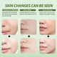 thumbnail image 4 of Mascarilla facial de gelatina Mnhybteam Professional, paquete de 1, 4 of 7