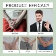 thumbnail image 3 of Googeer Essenz Prosta Vit Body Treatment-jc, 3 of 4