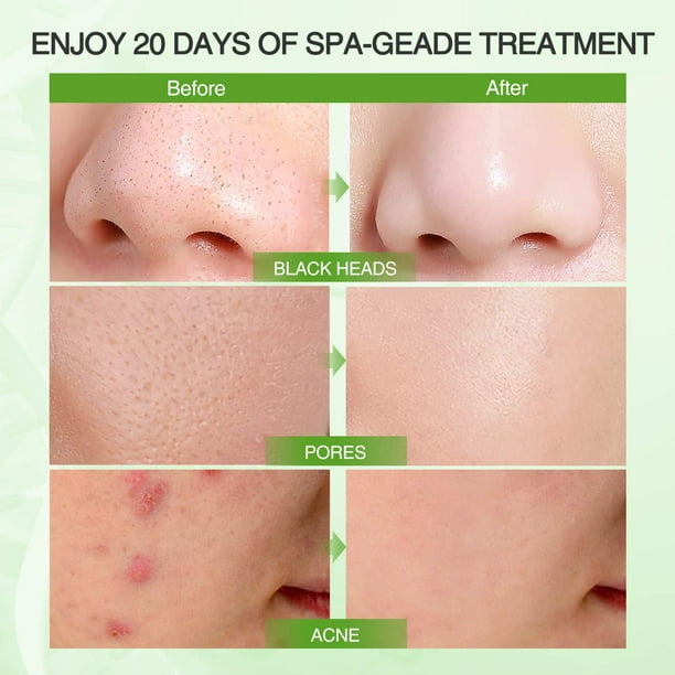 Clay Mask Organic Avocado Vegan Dead Sea Mud Mask Nourishing Hydration Deep Cleansing Relaxing & Hydrating Facial Treatment Blackhead Remover Smooth Skin Green Tea Natural Healing Clay Mask for Face Gift POP! -
