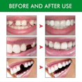 thumbnail image 2 of Temporary Tooth Replacement Kit Temp Repair 30g Tooth Glue x2pcs +Forceps x3pcs, 2 of 5