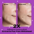 thumbnail image 3 of Avarelle Cosmetics Spot Patch PM Heavy Duty Hydrocolloid Acne Patch, 24 ct, 3 of 8