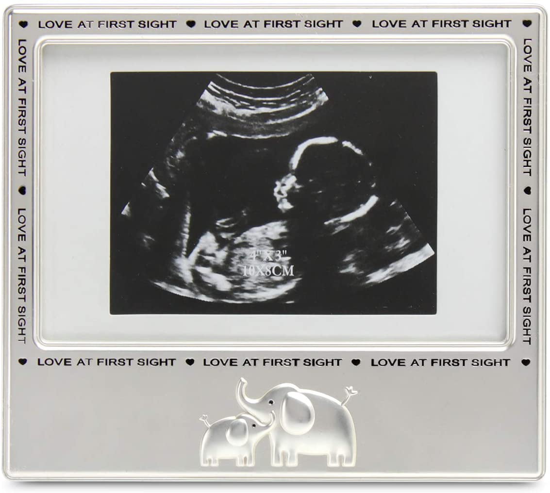 A miracle waiting  NEW Photo Frame Baby's Scan