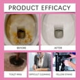thumbnail image 4 of Concentrated Toilet Bowl Cleaner, Toilet Drain Cleaning Sticks, Odor Removal Toilet Cleaner Bathroom Deodorizer, 4 of 5