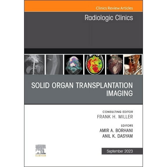 Clinics: Radiology Solid Organ Transplantation Imaging, an Issue of Radiologic Clinics of North America: Volume 61-5, Book 61, (Hardcover)