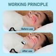 thumbnail image 3 of Z3 Pro Intelligent Snoring Solution, Professional 3-Speed Adjustment Anti-Snoring Device, Anti Snoring, Breathe Easy, Anti Snore, Sleep Soundly, 3 of 6