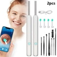 thumbnail image 1 of LNGOOR  Ear Wax Removal with Camera  1296P HD Wireless Earwax Remover Tool with 6 LED Lights and 8 Ear Pick Kit  Ear Cleaner for iOS & Android (Black), 1 of 7
