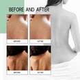thumbnail image 4 of Back Body Acne Treatment Spray with Salicylic Acid, 4 of 5