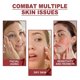 thumbnail image 3 of Collagen mask set - gentle moisturizing and nourishing facial skin, eye mask, and face mask skincare set., 3 of 4
