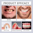 thumbnail image 2 of Advanced Customized Full Denture Set, Silicone Reline Denture Set-1pc-, 2 of 5