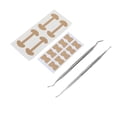 thumbnail image 1 of Tiras Correctoras De Uñas Encarnadas, Cómodas 120 Piezas Que Reducen El Dolor Operación Simple Kit De Tratamiento De Uñas Encarnadas De Diferentes Formas Herramienta De Acero, 1 of 7