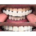thumbnail image 3 of Tirantes para dentaduras postizas blanqueadoras Flex Comfort Fit superior/inferior A, 3 of 5