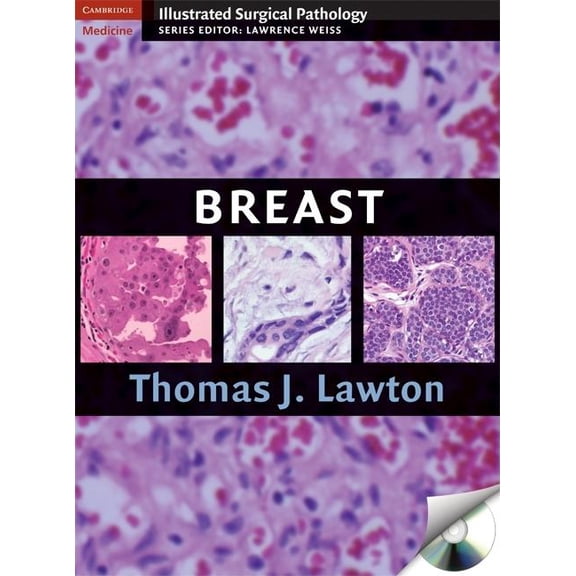 Cambridge Illustrated Surgical Pathology Breast, (Paperback)