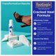 thumbnail image 4 of Loción FOOTLOGIX Cracked Heel Formula de 125 ml para piel seca, 4 of 9