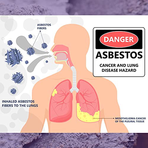 Pro-lab AS108 Asbestos Do It Yourself Test Kit for sale online 