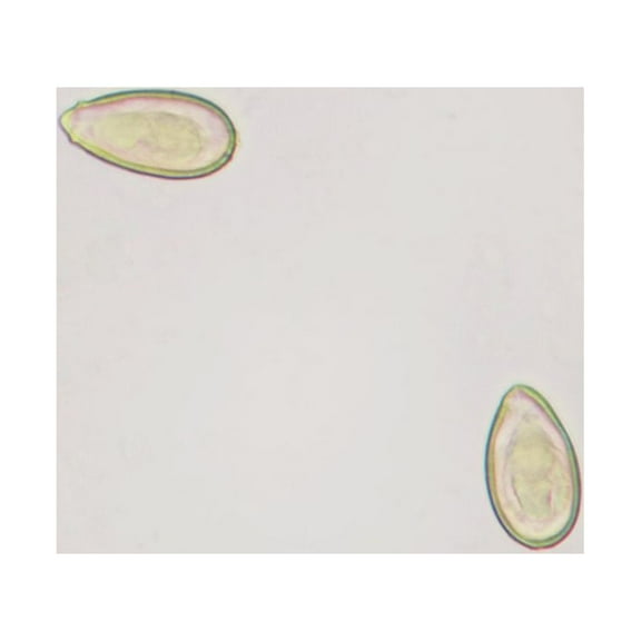 Clonorchis Sinensis Eggs Slide, W.M.