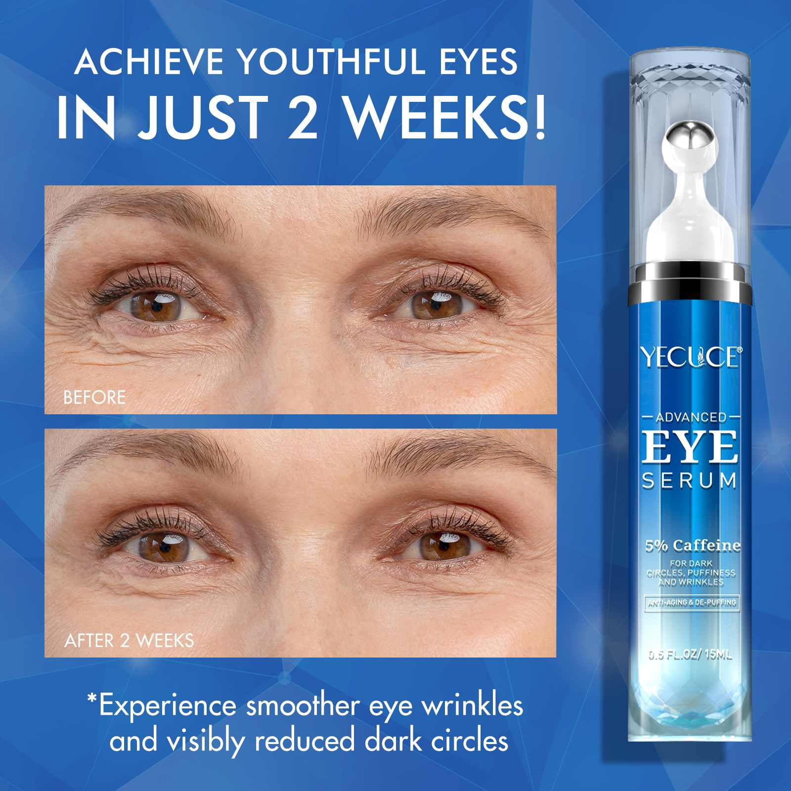 (3 pack) Yecuce Eye Serum with Roller Massage Ball, Caffeine Peptide, Dark Circles Under Eye Treatment, with Retinol, 5ml