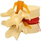 thumbnail image 1 of Lumbar Vertebrae Model Anatomical Spine Lumbar Disc Herniation Anatomy Teaching Tool Lumbar Vertebr, 1 of 5