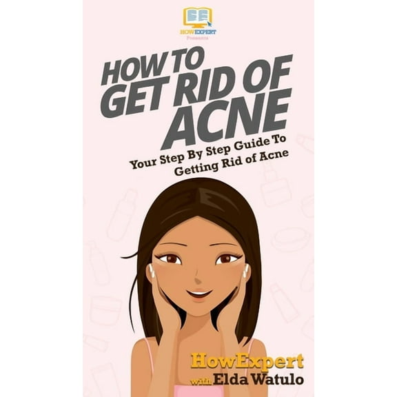How To Get Rid of Acne: Your Step By Step Guide To Getting Rid of Acne, (Hardcover)