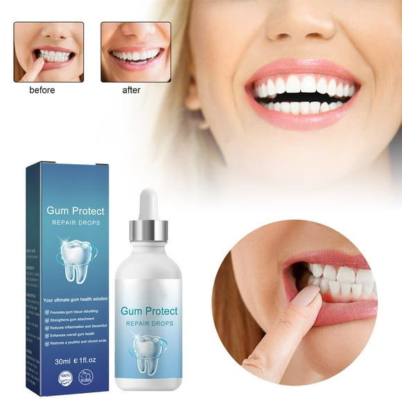 VOKE Teeth Cement Veneer ning Teeth ning Plaque Remover ning Booster And Plaque Remover for Teeth 30ml Super Strong Oral Care Solution Effective In Removing And Revitalizing And Your !