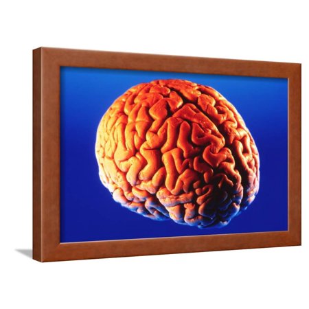 Human Brain Framed Print Wall Art By Volker Steger