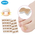 thumbnail image 2 of 50pcs Ingrown Toenail Corrector Stickers With Double Sided Tape Paronychia Corrector Pedicure Tools, 2 of 8