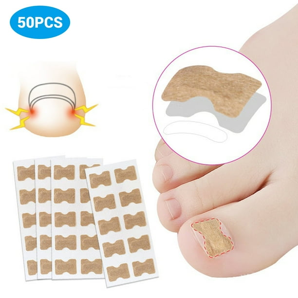 50 Uds pegatinas correctoras de uñas encarnadas con cinta de doble cara corrector de paroniquia herramientas de pedicura