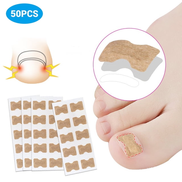 50 Uds pegatinas correctoras de uñas encarnadas con cinta de doble cara corrector de paroniquia herramientas de pedicura