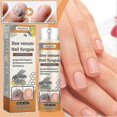 thumbnail image 4 of Fungals Treatments Spray For Toenail Fingernail Super Strength Antifungals Liquid For All Nail Type, 4 of 5