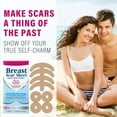 thumbnail image 4 of Silicone Scar Sheets for Breast, Silicone Scar Tape, Reusable and Effective Breast Silicone Scar Sheets, 4 Pairs, 4 of 8