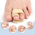 thumbnail image 4 of Adjustable Toe Straightener Breathable Bunion Corrector Non-Deformed Foot Wear Aluminum Plate Toe Finger Support Fixed, 4 of 9