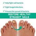 thumbnail image 3 of 3pcs Nail Onychomycosis Cream Feet Heeling Gray Nails Moisture Cream For Women Men Daily Nail Care, 3 of 3